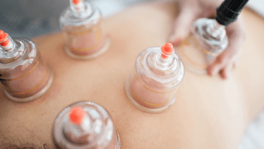 Image for Cupping and 2 hour massage