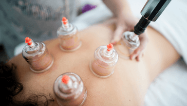 Image for Cupping and 90 Minute Massage